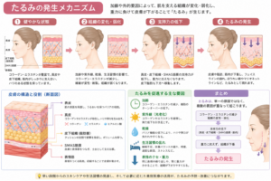 たるみの発生メカニズム
