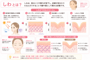 しわとは？